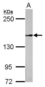 RAD50 Antibody (Internal)