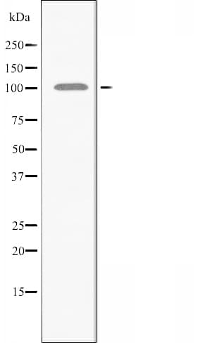 AMPD2 Antibody