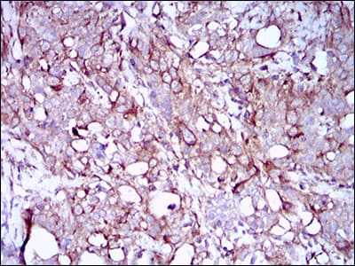 Monoclonal Mouse anti-Human SYCP3 / SCP3 Antibody (clone 6F9C5, aa27-128, IHC, IF, WB)