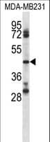 Polyclonal Rabbit anti-Human CD84 / SLAMF5 Antibody (aa232-260, WB)