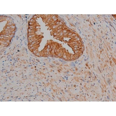 MAPT / Tau Antibody (phospho-Ser404)