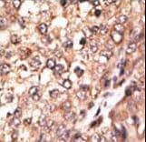 Polyclonal Rabbit anti-Human BMP7 Antibody (aa15-44, IHC, IF, WB)