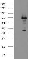 PGM3 Antibody (clone OTI1B8)