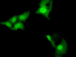 Monoclonal Mouse anti-Human MMS21 / NSMCE2 Antibody (clone OTI4A2, IF, WB)