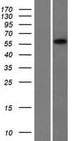 CCDC9 Protein (Over-Expression Lysate Myc-DDK (Flag))