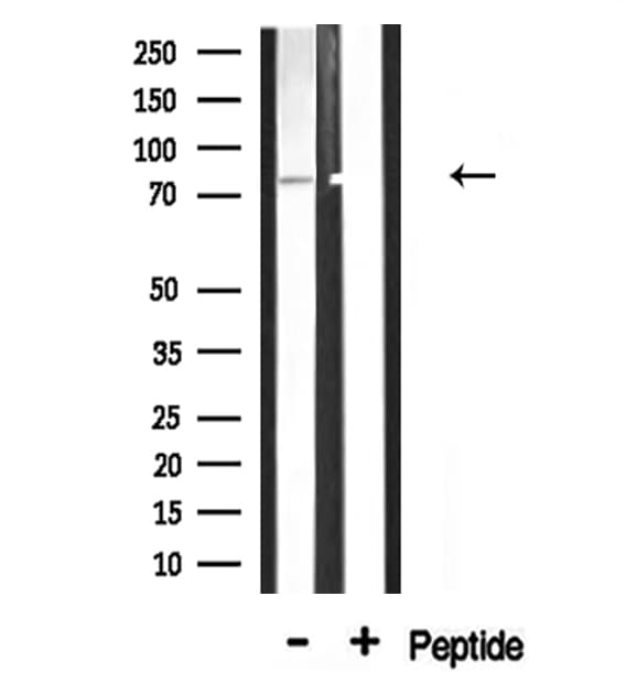 Polyclonal Rabbit anti-Human ADD3 Antibody (IF, WB)