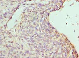 RBBP7 / RbAp46 Antibody (aa1-230)