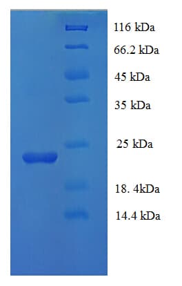 Human CASP7 / Caspase 7 Protein (Recombinant His)