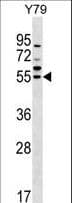 Polyclonal Rabbit anti-Human FDXR Antibody (aa459-487, WB)
