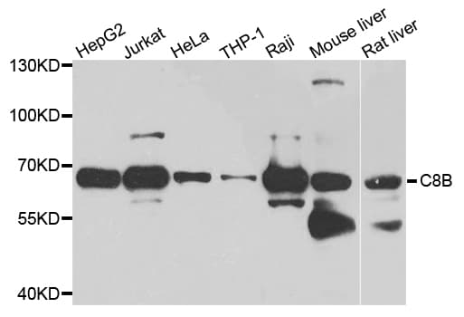 Complement C8b Antibody (aa55-350)