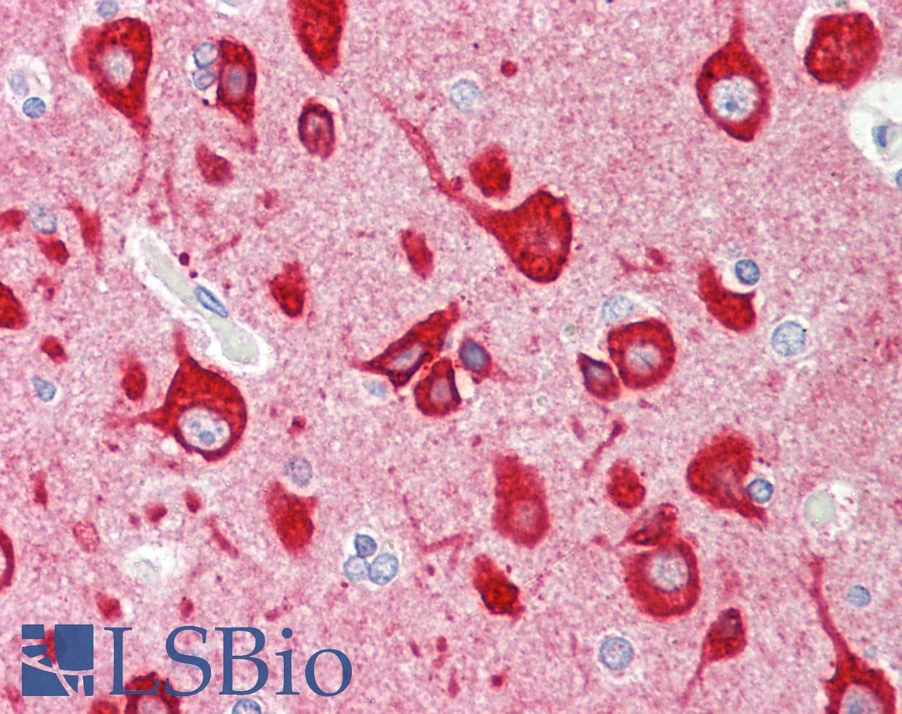 IHC-plus™ Polyclonal Rabbit anti-Human VILIP / VSNL1 Antibody (aa47-75, IHC, WB)