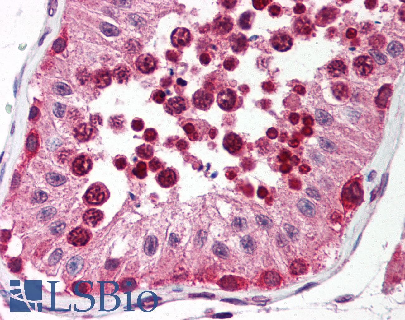 IHC-plus™ UNG / Uracil DNA Glycosylase Antibody