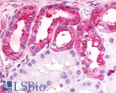 PathPlus™ TPRA1 / GPR175 Antibody (Cytoplasmic Domain)