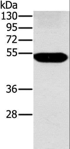 Polyclonal Rabbit anti-Human Alpha Fucosidase / FUCA1 Antibody (IHC, WB)