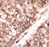 BMP3 Antibody (aa8-36)