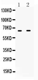 Polyclonal Rabbit anti-Human IFNAR1 / IFNAR Antibody (WB)