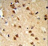 ATXN3 / JOS Antibody (aa261-288)
