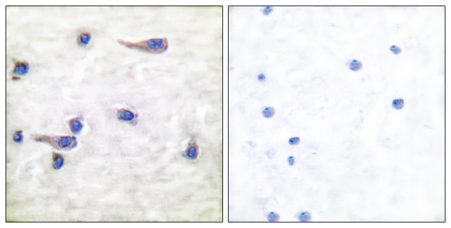 MAPT / Tau Antibody (phospho-Thr212)