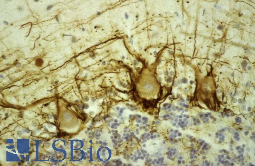 NEFH / NF-H Antibody (clone NAP4)
