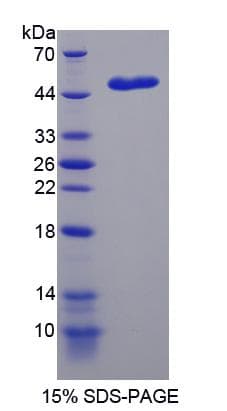 Human NME5 Protein (Recombinant His-S)
