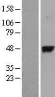 GGH / Gamma-Glutamyl Hydrolase Protein (Over-Expression Lysate Myc-DDK (Flag))