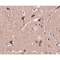 Polyclonal Rabbit anti-Human ZNF667 / MIPU1 Antibody (IHC, IF, WB)