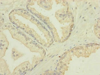 IF3mt / MTIF3 Antibody