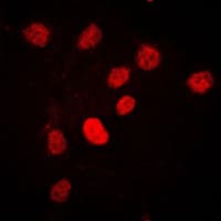 CSTF2 / CstF-64 Antibody (N-Terminus)