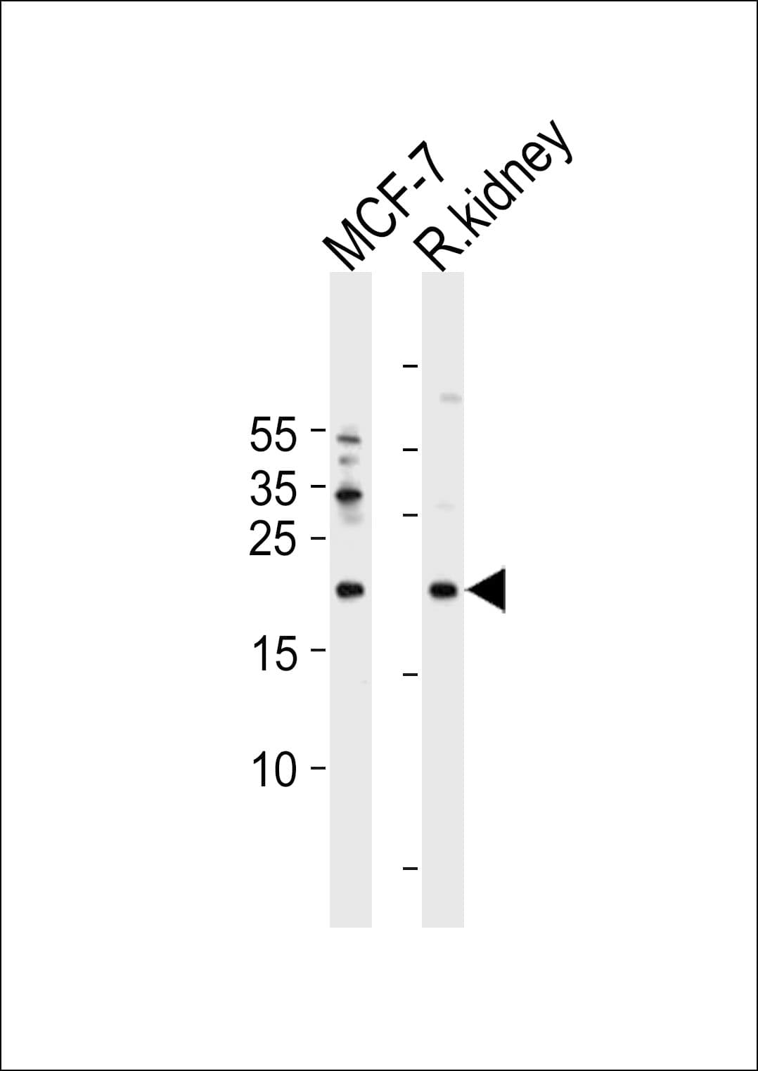 IHC-plus™ APRT Antibody (aa143-170)