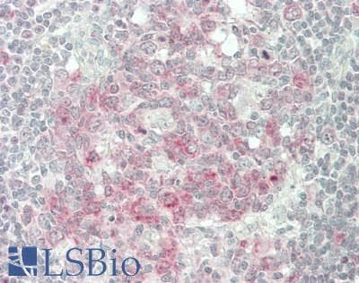 IHC-plus™ TFEB Antibody