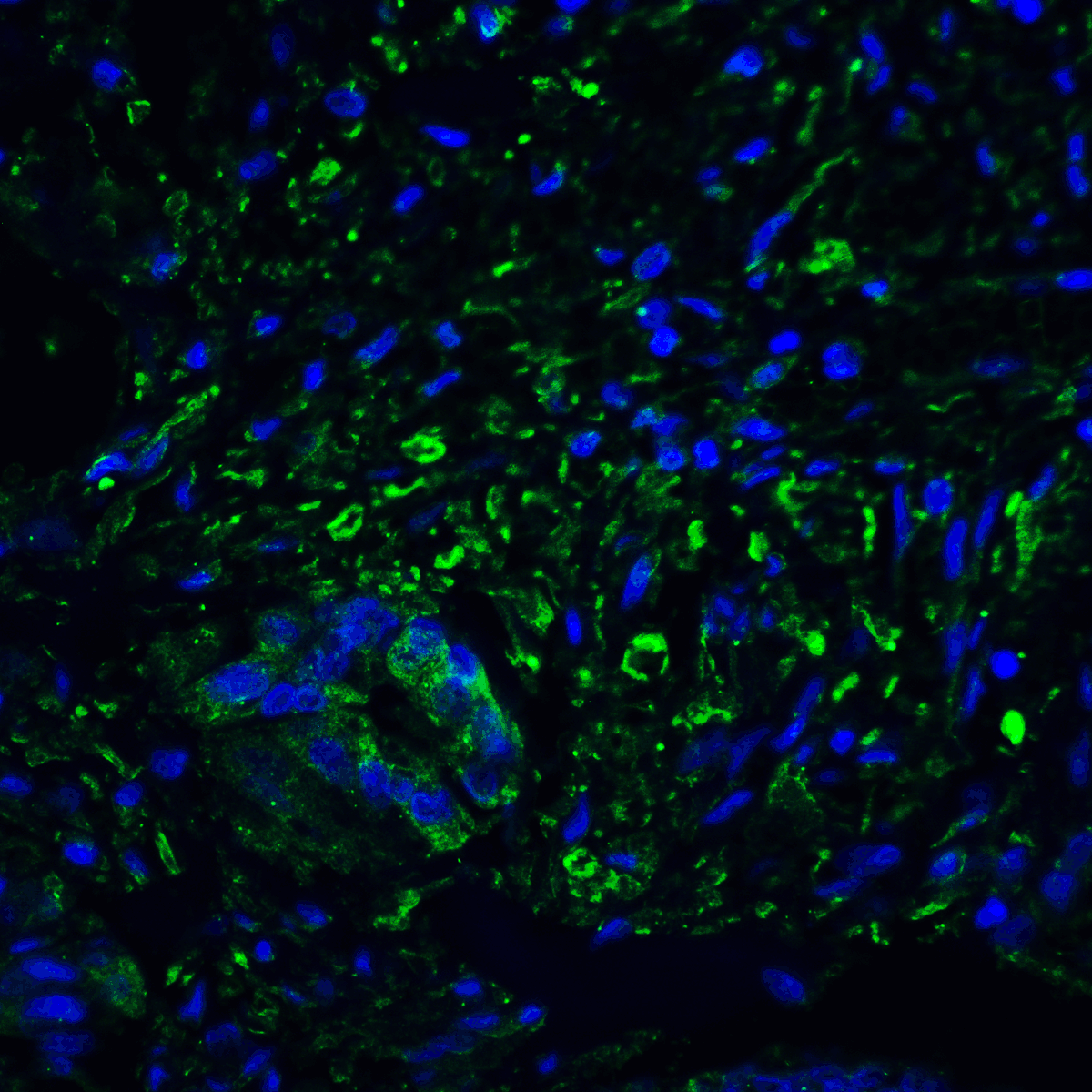 IHC-plus™ PD-L2 / PDCD1LG2 / CD273 Antibody (clone 8C12)