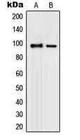 Polyclonal Rabbit anti-Human PML Antibody (N-Terminus, IHC, IF, WB)