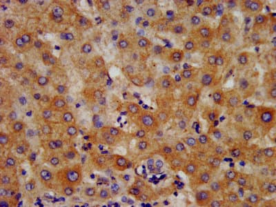 HMGCS2 / HMG-CoA Synthase 2 Antibody