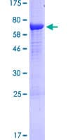 Human PCOLCE Protein (Recombinant GST)