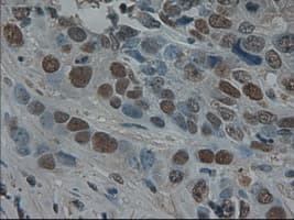 AMY2A / Pancreatic Amylase Antibody (clone OTI6D4)