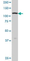IHC-plus™ ADAMTS17 Antibody (clone 3B7)