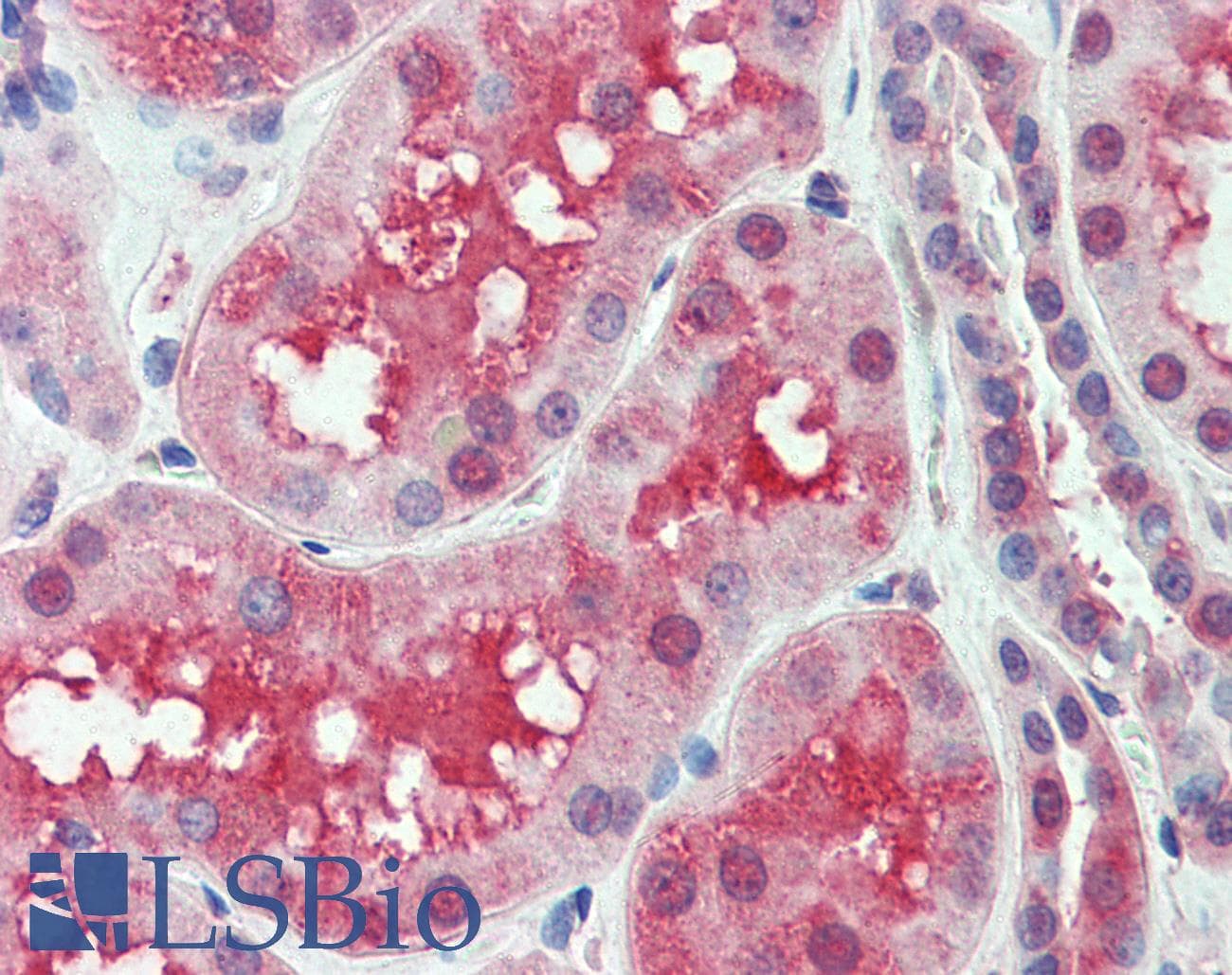 IHC-plus™ SLC44A2 / CTL2 Antibody (Internal)