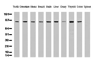 Monoclonal Mouse anti-Human ALDH1L1 Antibody (clone UMAB43, IHC, IF, WB)