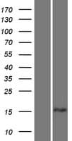 TPD52L1 Protein (Over-Expression Lysate Myc-DDK (Flag))