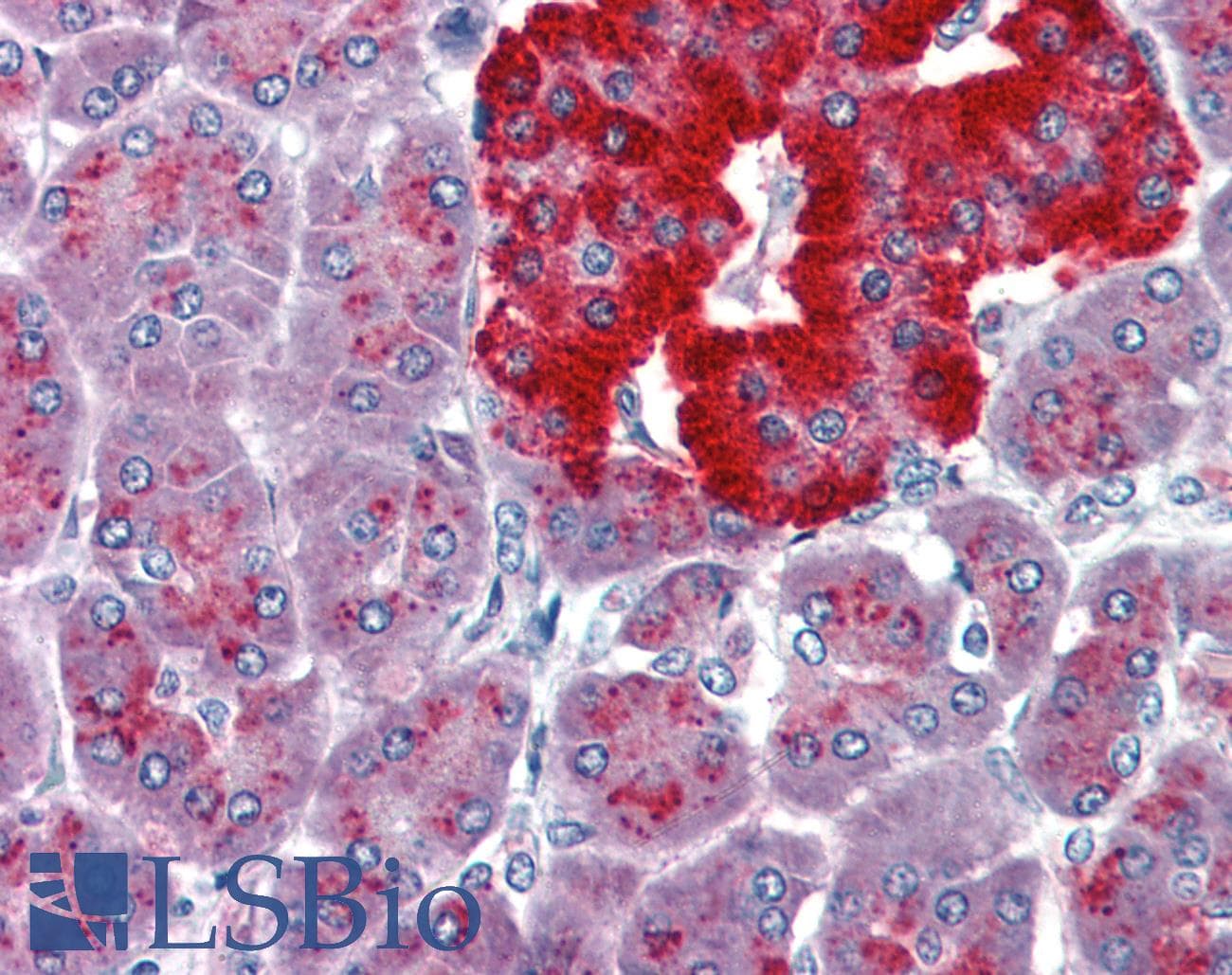Polyclonal Rabbit anti-Human PAX4 Antibody (aa166-215, IHC, WB)