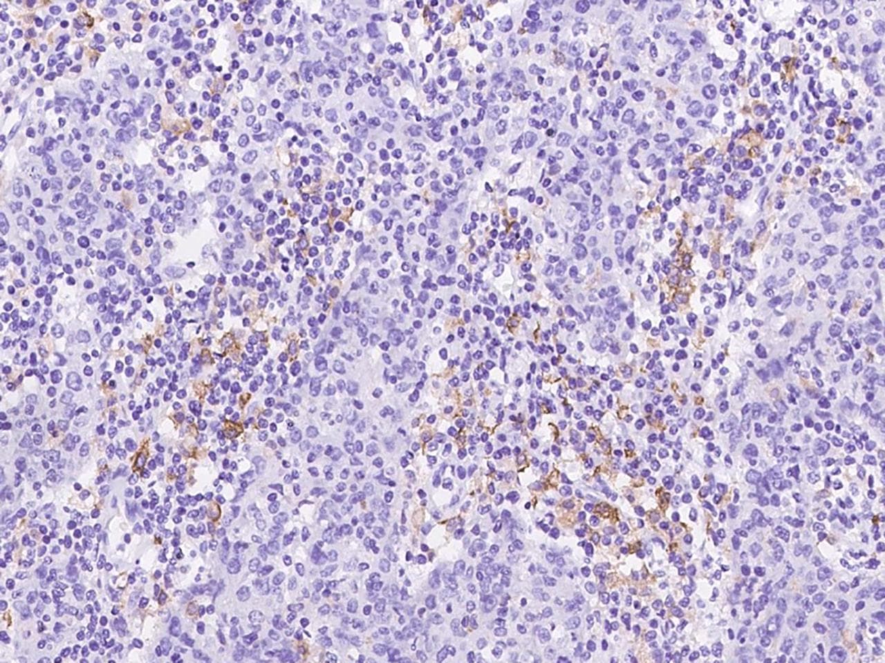 CD163 Antibody