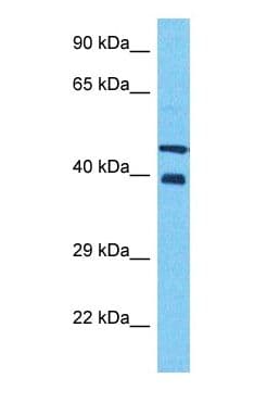 NIP45 / NFATC2IP Antibody (N-Terminus)