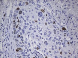 MKI67 / Ki67 Antibody (clone OTI5B10)