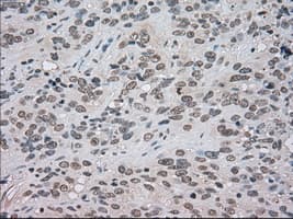 BUB1B / BubR1 Antibody (clone OTI5D9)