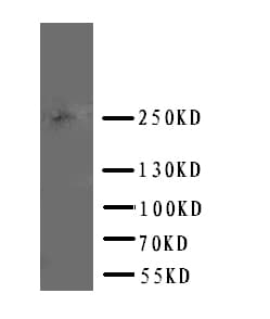 Polyclonal Rabbit anti-Human ABCA4 Antibody (aa1893-1906, WB)