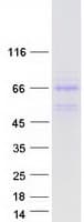 Human DNAJA3 / TID1 Protein (Recombinant Myc-DDK (Flag))