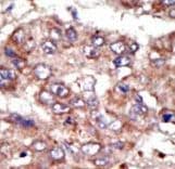 ACSL6 Antibody (aa240-270)