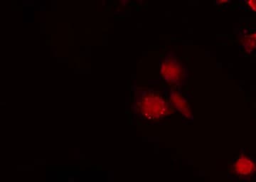 RBM6 / 3G2 Antibody