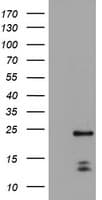 PYCARD / ASC / TMS1 Antibody (clone OTI2A7)