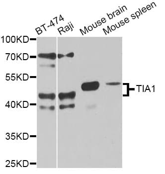 TIA-1 Antibody